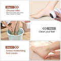 Callus Remover with Built-In Vacuum Rechargeable Motorized Electric Feet Foot File Pedicure Tool Exfoliation Dead Skin